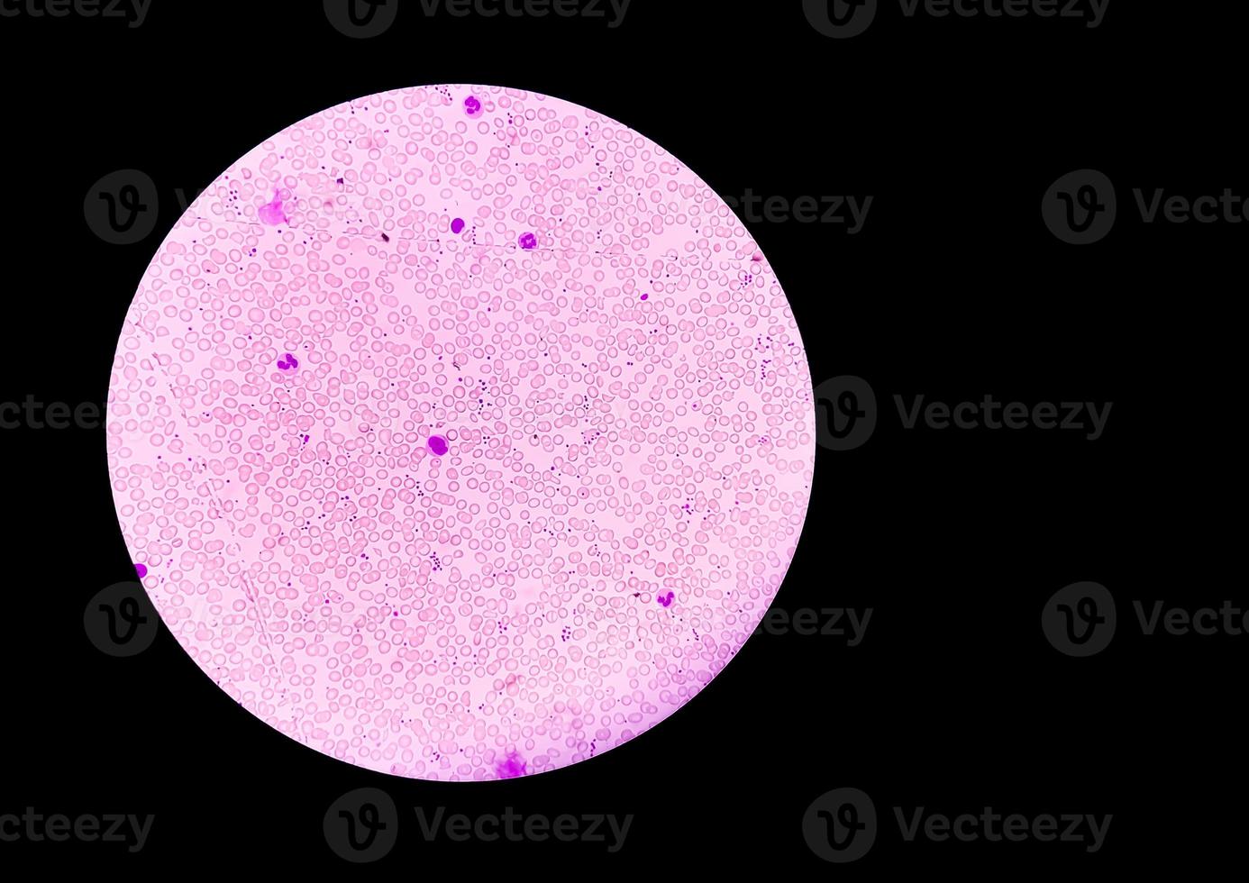 Microscopic view of Hematology slide . close view. photo