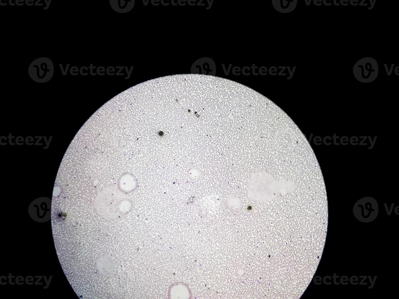 Microscopic view of stained slide of Hematology in laboratory. close up. total blood count. photo