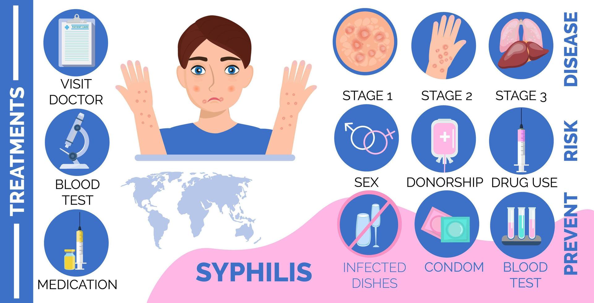 Syphilis disease, reasons and consequences, stages infographic for infected man. Sexual infections risk concept vector in cartoon style.