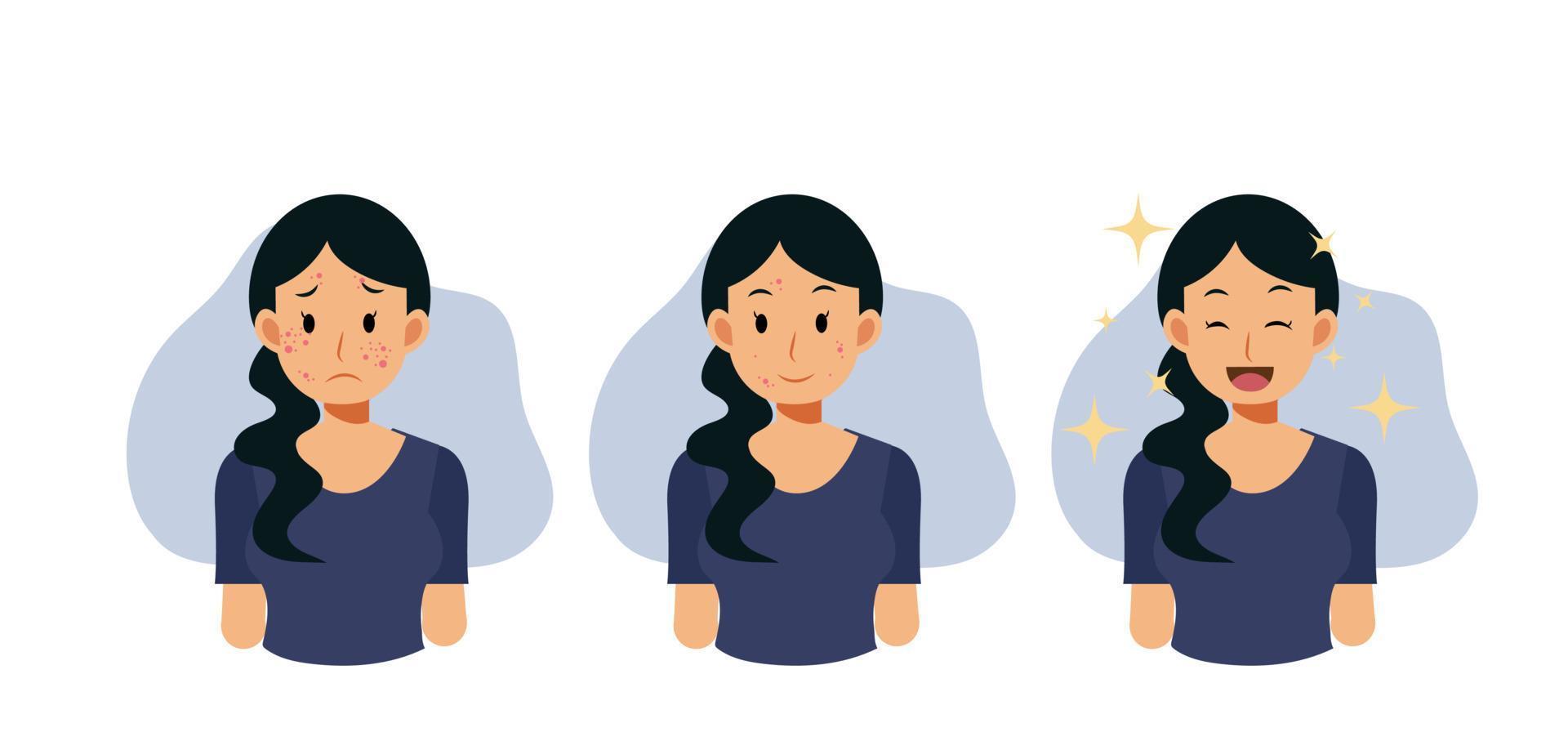Acne concept.pimples. skin problems. step of Clear of acne.Flat vector cartoon character illustration.