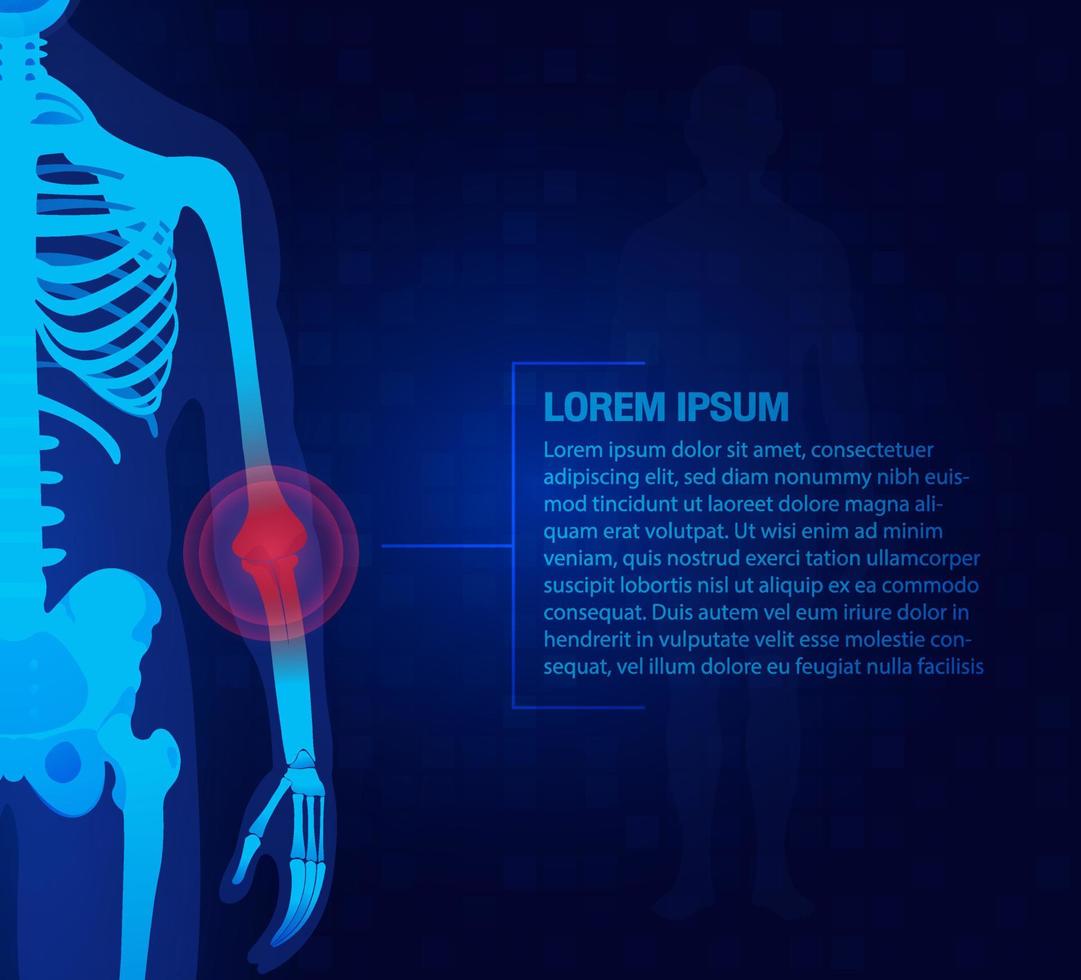 Pain of the elbow joints concept as skeleton. Blue background and red injury man body leg medicine template. Painful Joints.Rheumatism or rheumatic disorder medical. vector