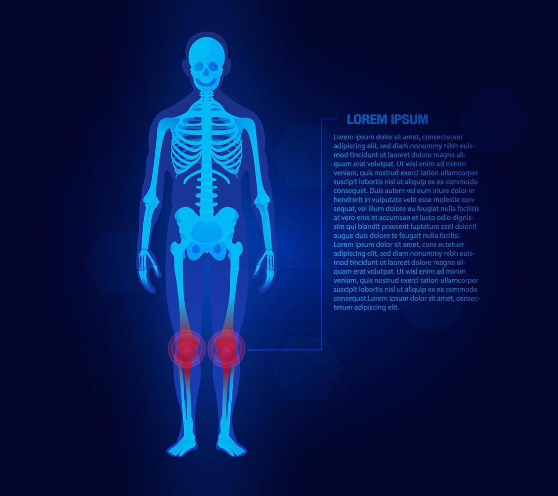 concepto de dolor de las articulaciones de la rodilla. Fondo azul y rojo plantilla de medicina de pierna de cuerpo de hombre de lesión. articulaciones dolorosas. reumatismo o trastorno reumático médico. vector