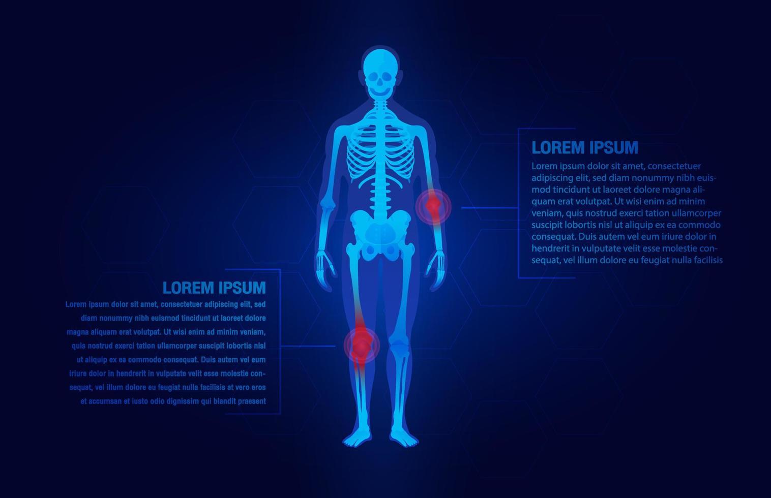 dolor del concepto de las articulaciones del codo y la rodilla como esqueleto. plantilla de medicina de pierna de cuerpo de hombre de fondo azul y lesión roja. Articulaciones dolorosas. Reumatismo o trastorno reumático médico. vector