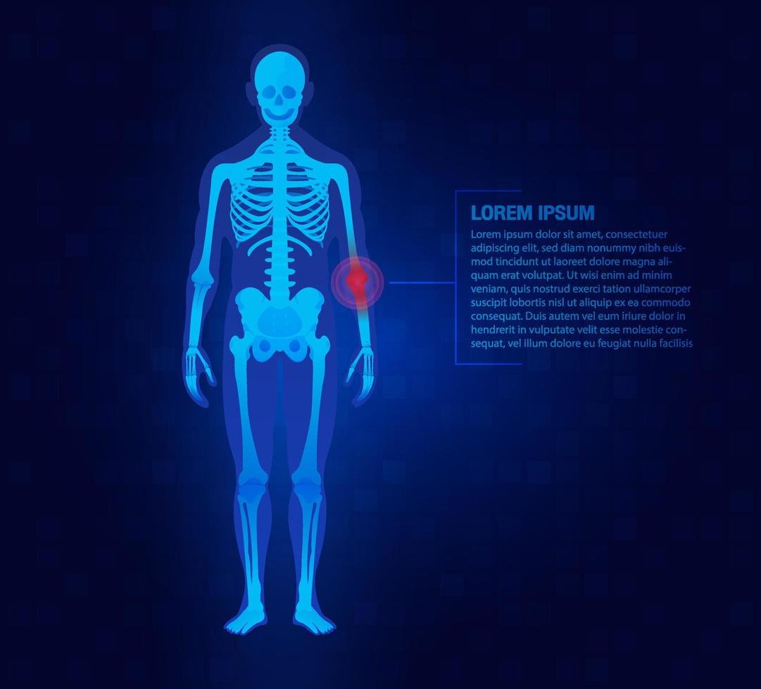 Pain of the elbow joints concept as skeleton. Blue background and red injury man body leg medicine template. Painful Joints.Rheumatism or rheumatic disorder medical. vector