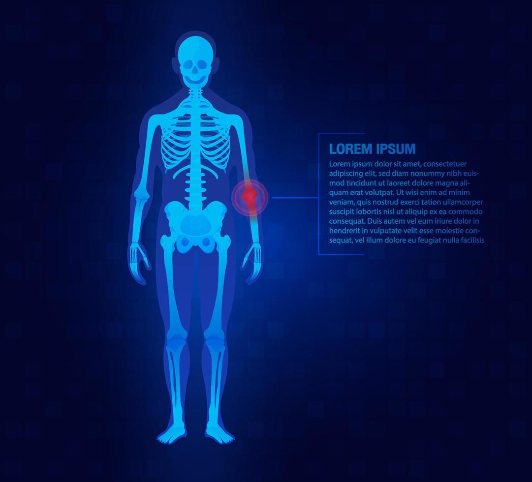 dolor del concepto de las articulaciones del codo como esqueleto. Fondo azul y rojo plantilla de medicina de pierna de cuerpo de hombre de lesión. articulaciones dolorosas reumatismo o trastorno reumático médico. vector