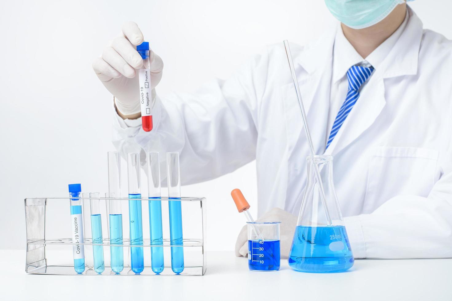 laboratory assistant hand is holding blood test infected Covid-19 photo