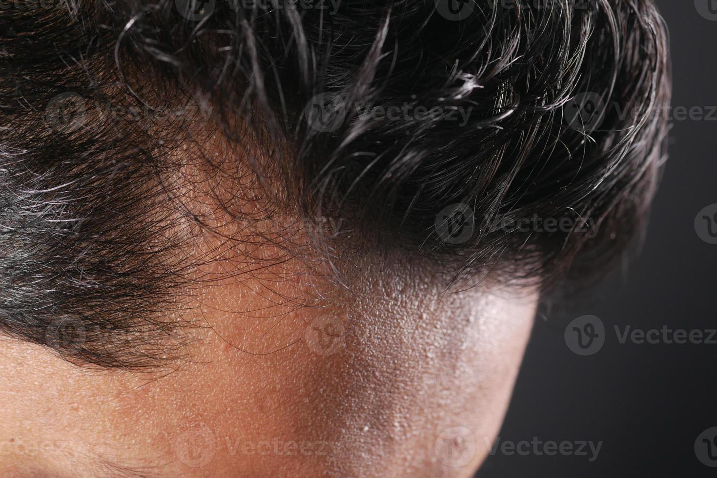 hair loss concept with man checking his hair photo