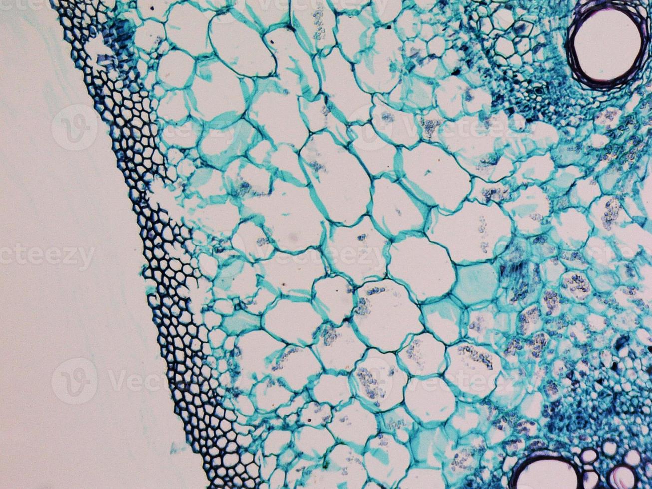 Cucurbita stem micrograph photo