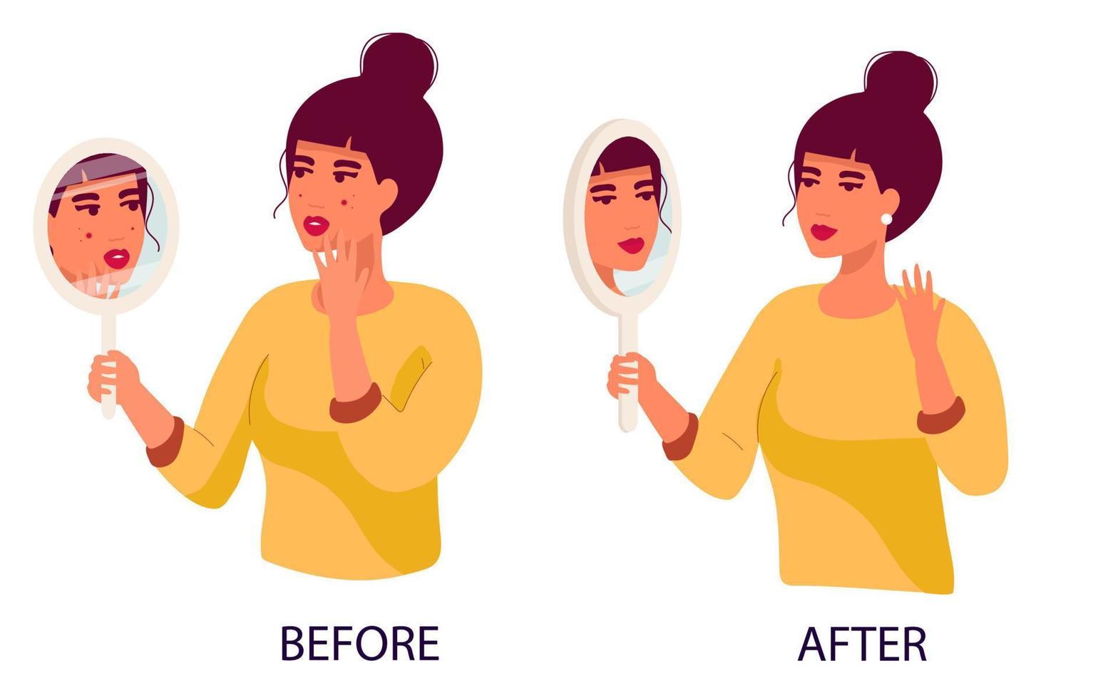 set of women sad Young woman hand mirror worrying about her acne on face in flat design. Pimple problem on female skin. and a satisfied girl with her skin condition. Before after vector
