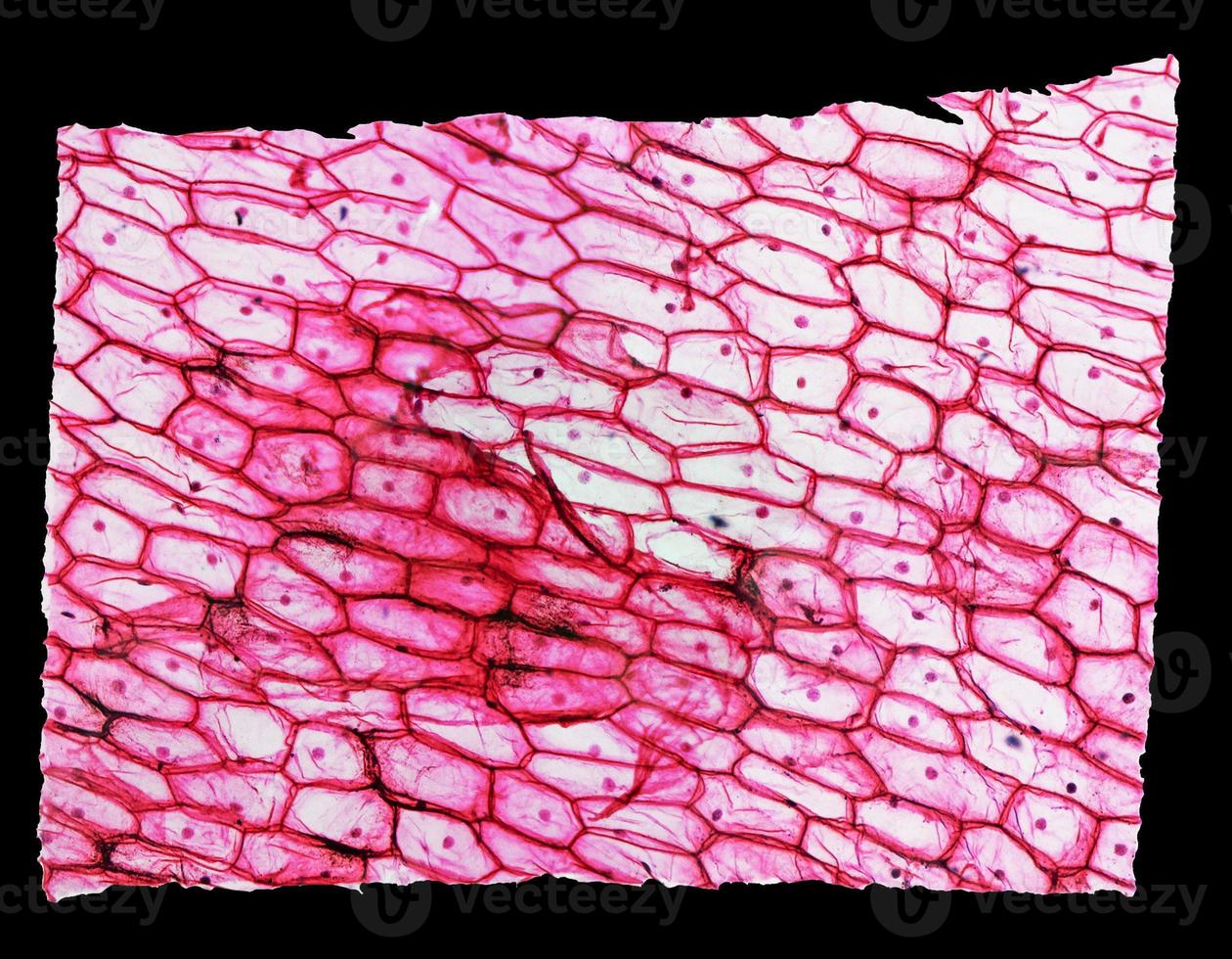 Onion epidermus micrograph photo