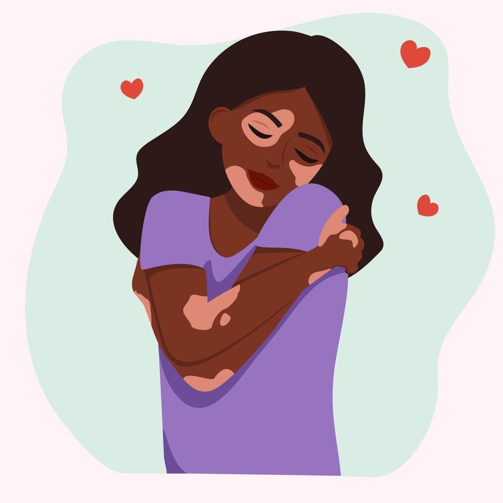 Girl with vitiligo. girl hugs herself. vector