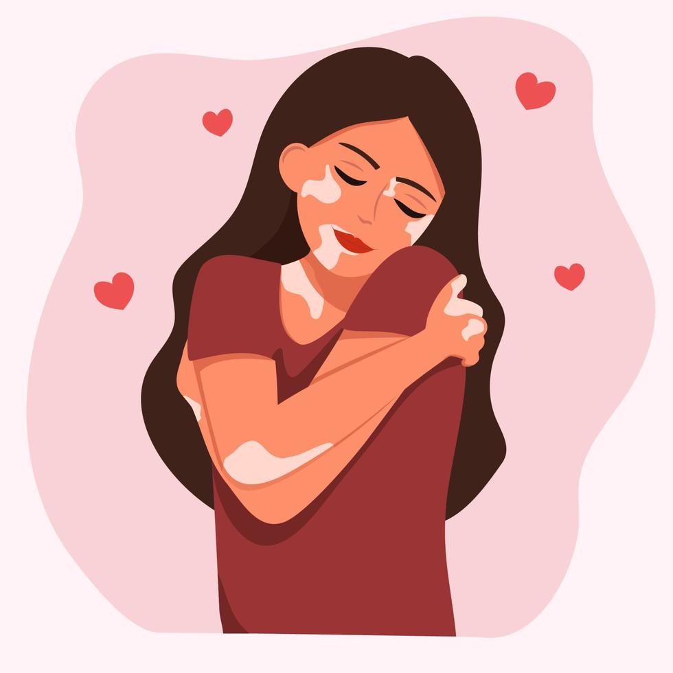 Girl with vitiligo. girl hugs herself. vector