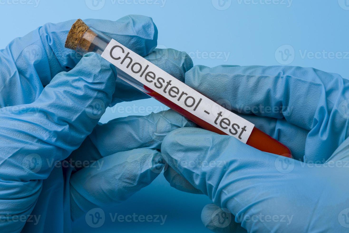 Hand Holding a Cholesterol Test in a test tube on a Blue Background. photo