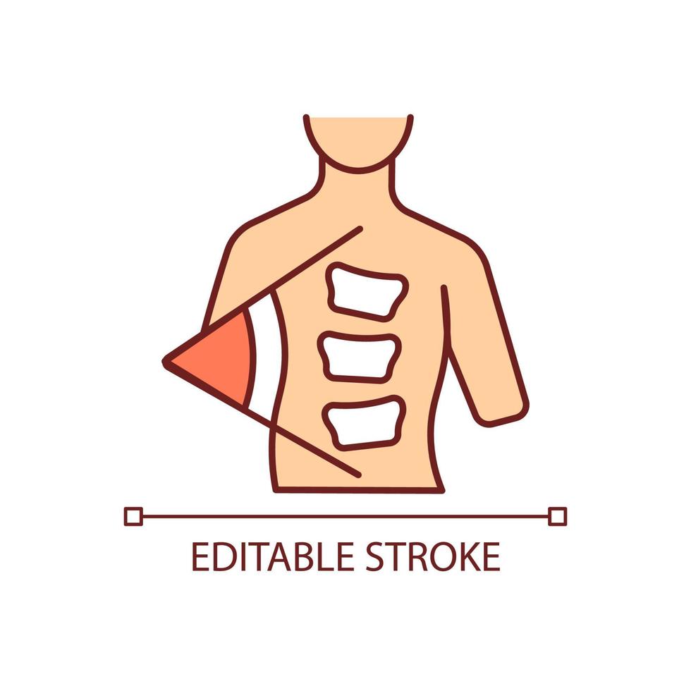 Cobb method RGB color icon. Cobb angle. Scoliosis degree measurement. Spine curve angle calculation. Backbone deformation. Isolated vector illustration. Simple filled line drawing. Editable stroke