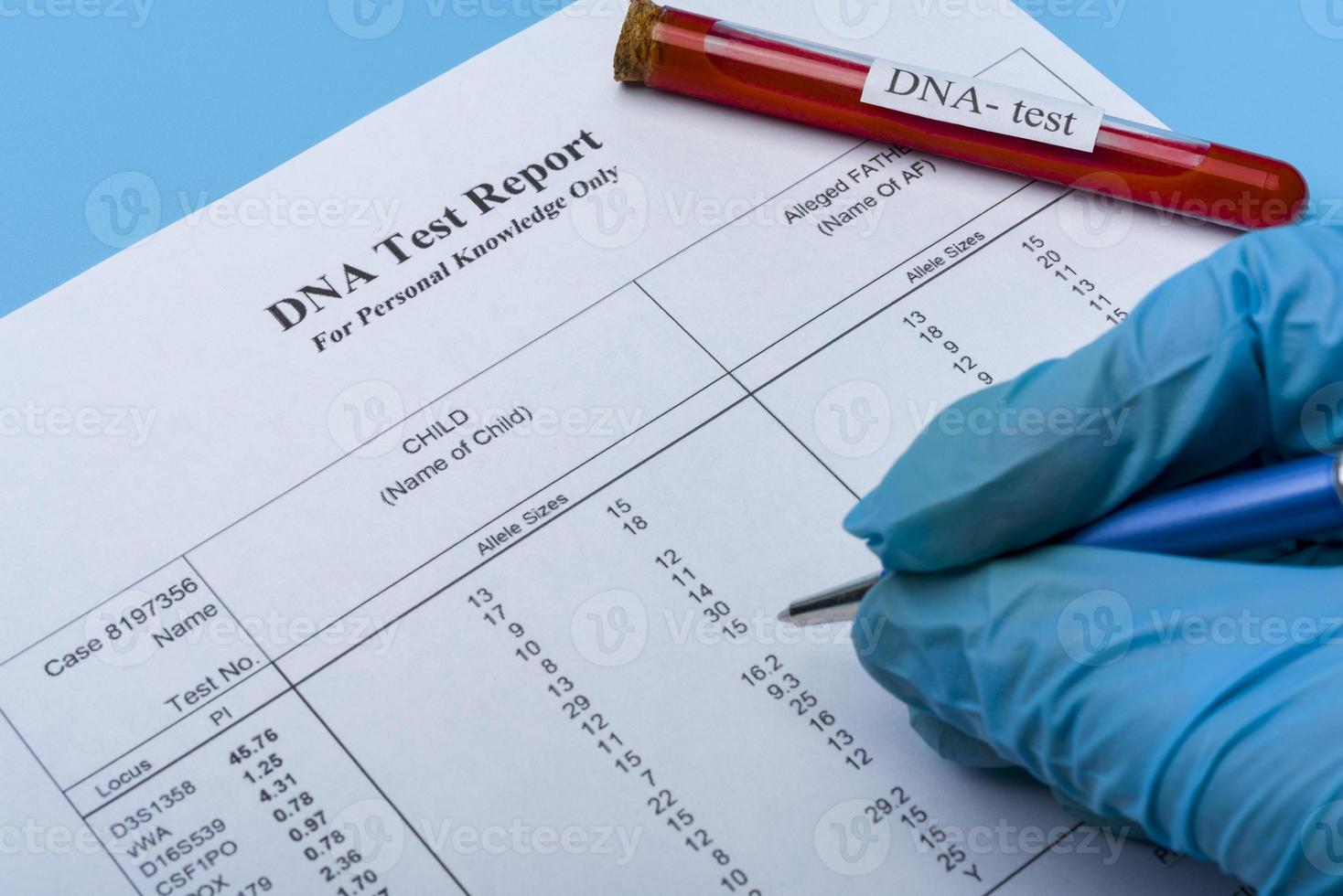 DNA molecule forming inside the vial in for blood analysis.3D rendering, conceptual images. photo