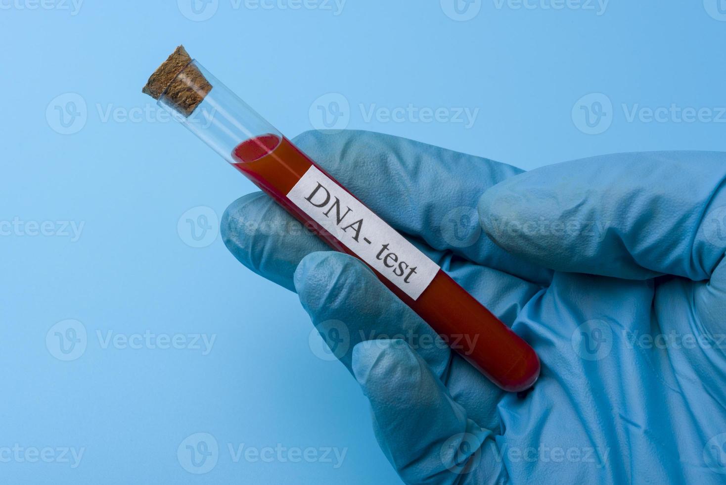 Hand Holding a DNA Test in a test tube on a Blue Background. photo