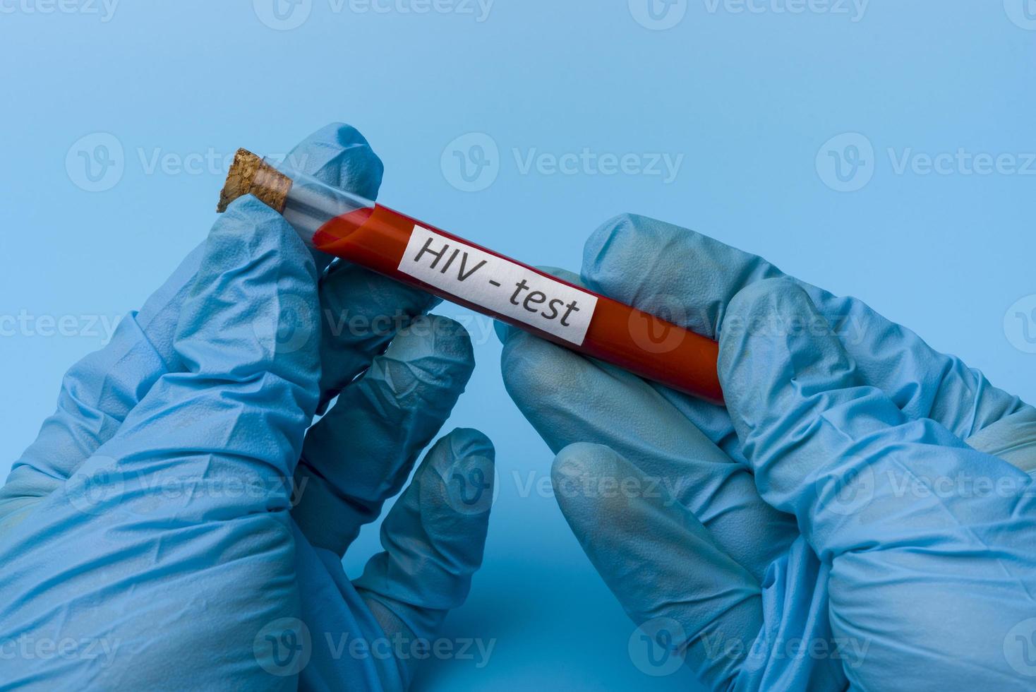 Hand Holding a Test for a Full blood Test in a test tube on a Blue Background. photo