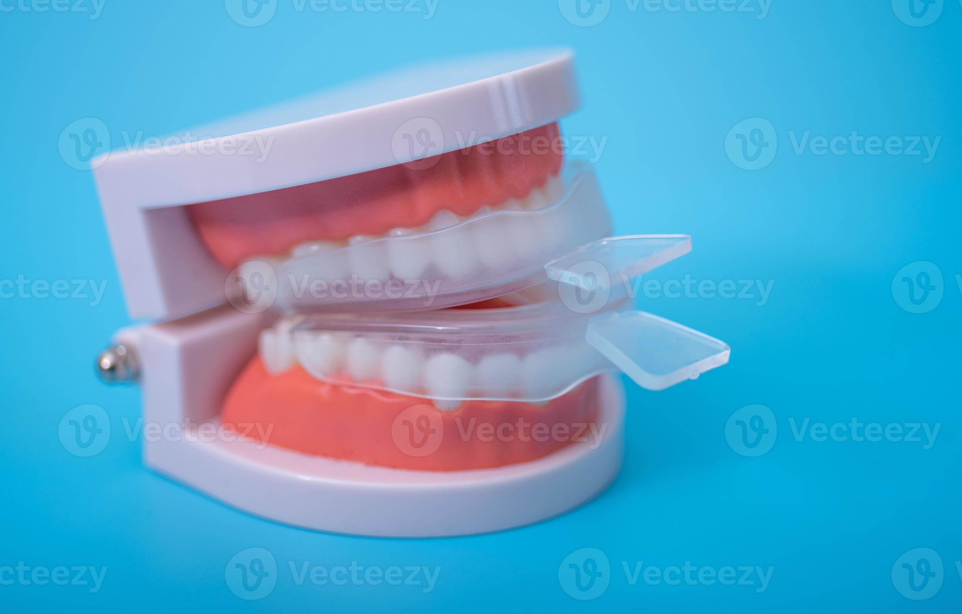 individual tooth tray for whitening and mold. imitation of a denture
