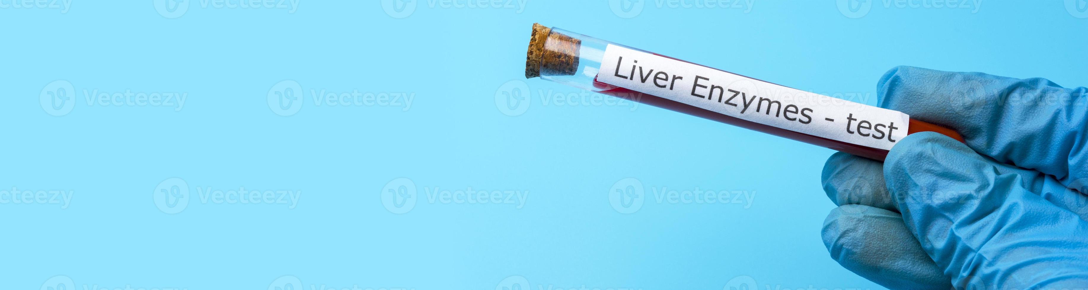 Hand Holding liver enzyme Test in vitro on Blue Background. Copy space. photo