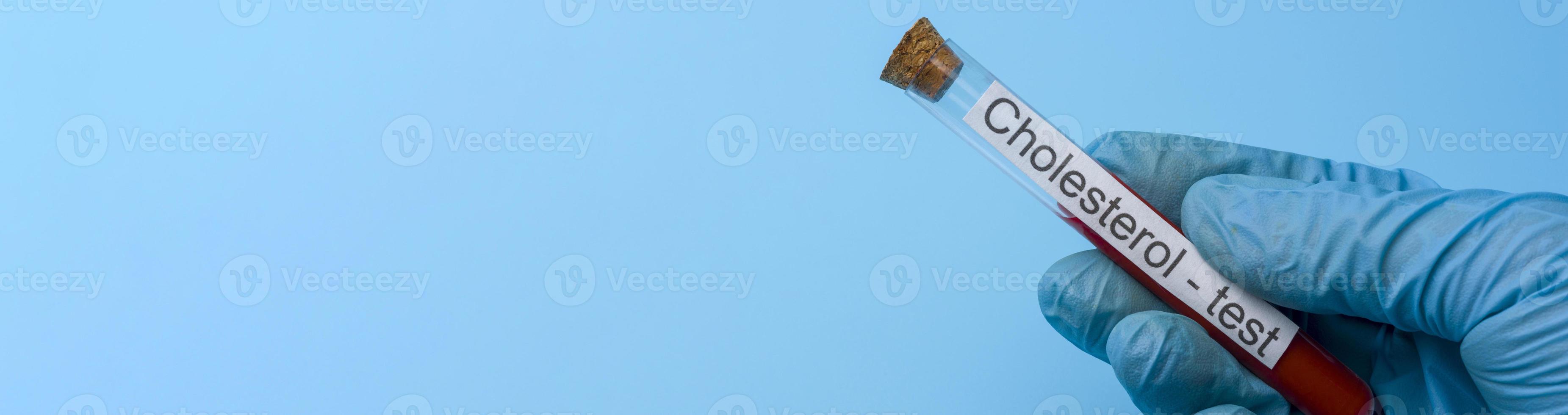 A hand holds a cholesterol test in a test tube on a blue background. Place under the text. photo