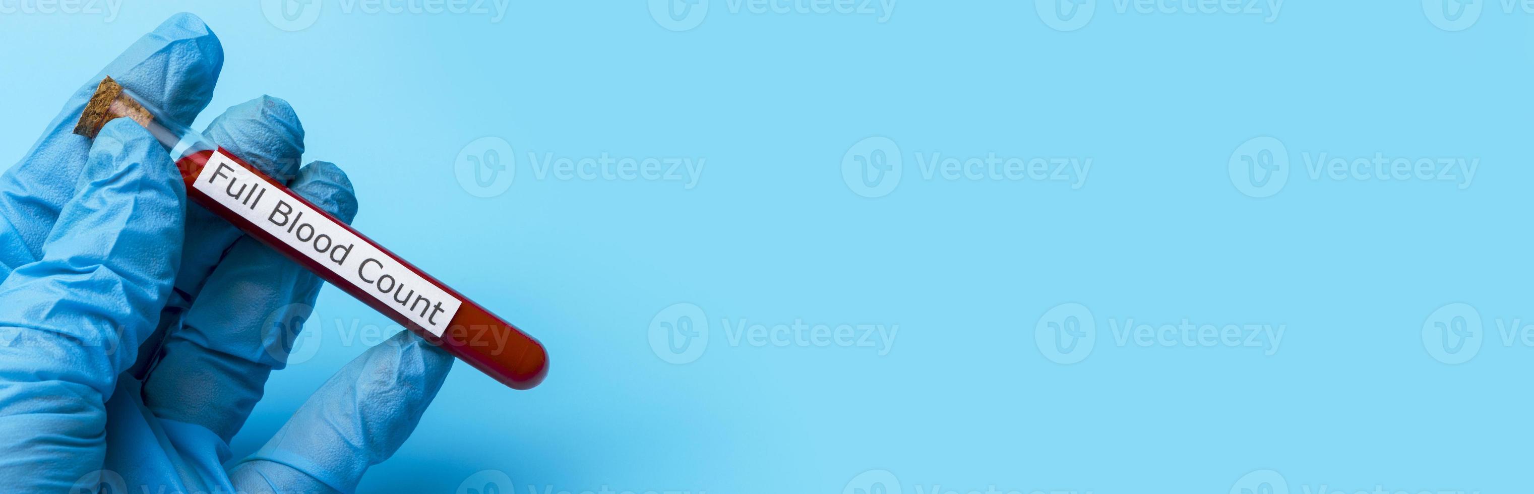 Hand Holding a Test for a Full blood Test in a test tube on a Blue Background. Copy Space photo