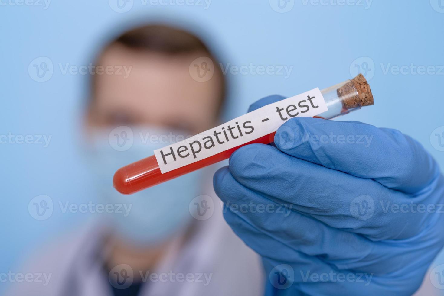 Hands in medical gloves holding a flask of blood for a hepatitis test. photo