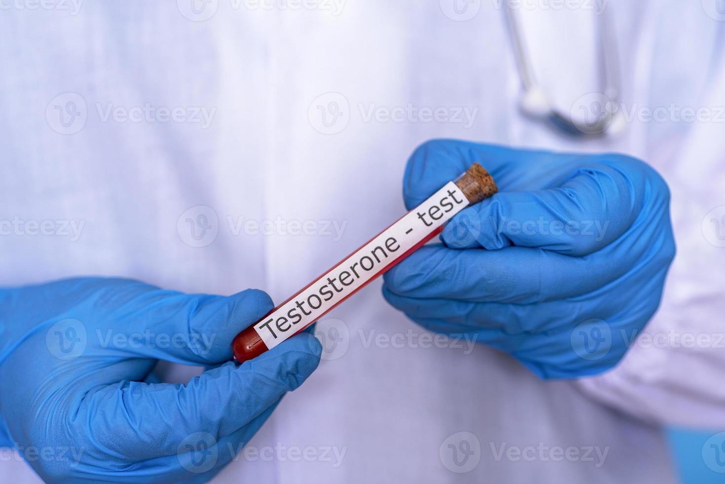 Hands in medical gloves hold a flask of blood for a testosterone test. photo