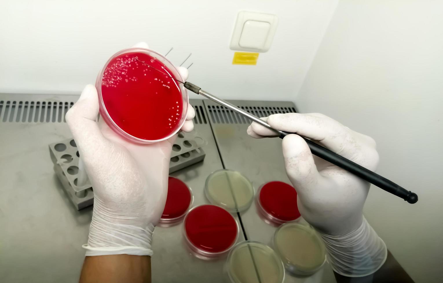 científico que analiza la placa de petri en el laboratorio o microbiólogo que trabaja con la placa de petri para su análisis en el laboratorio de microbiología foto