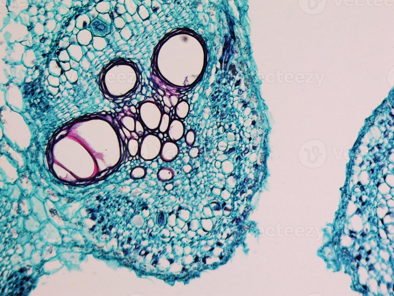 Cucurbita stem micrograph photo