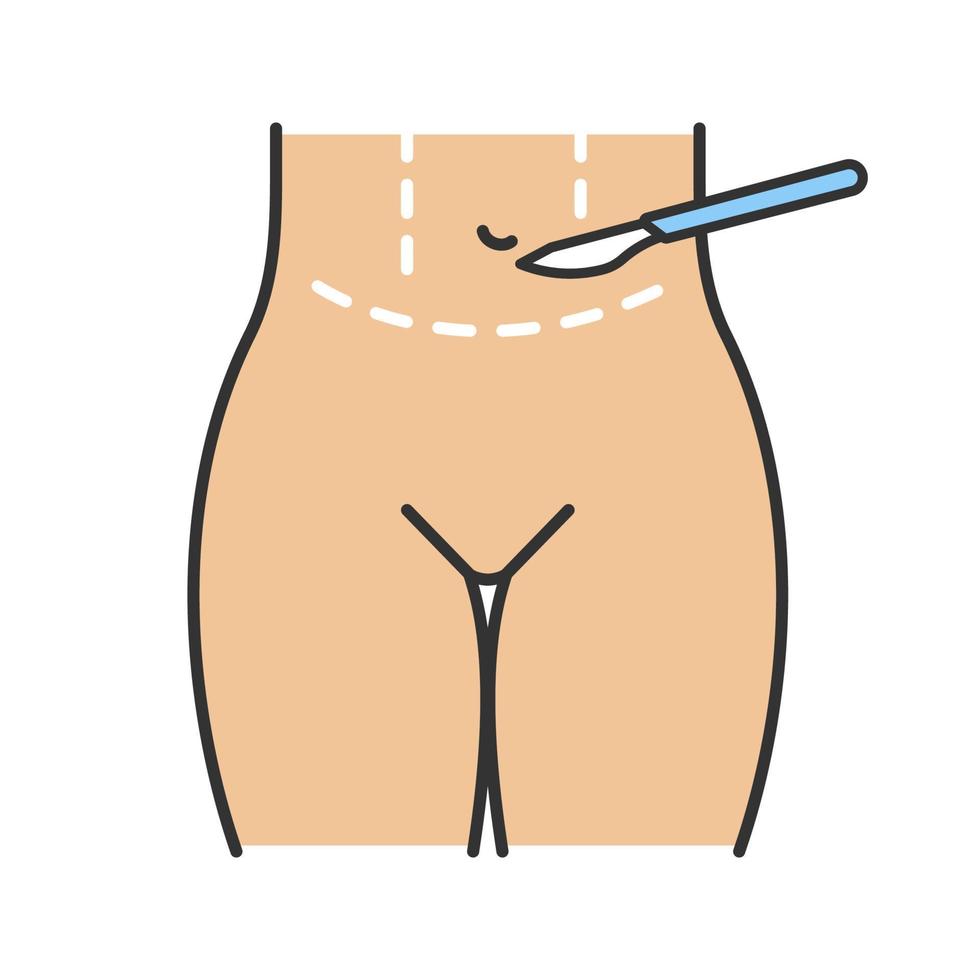Tummy tuck plastic color icon. Abdominoplasty. Stomach liposuction. Abdominal lifting. Plastic surgery. Isolated vector illustration