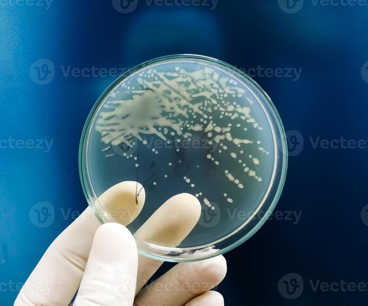 Closeup of gram negative bacteria growth on HiCrome UTI Agar with white scientist hand holding photo