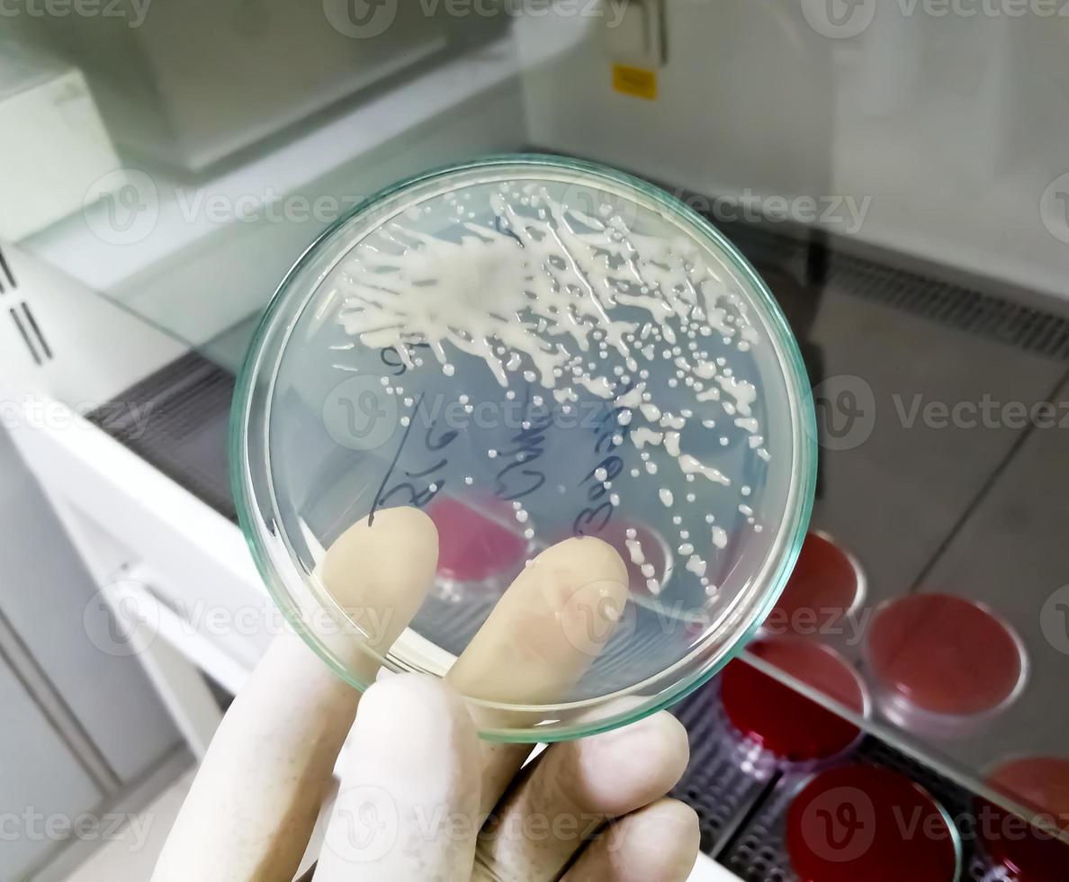Closeup of gram negative bacteria growth on HiCrome UTI Agar with white scientist hand holding photo