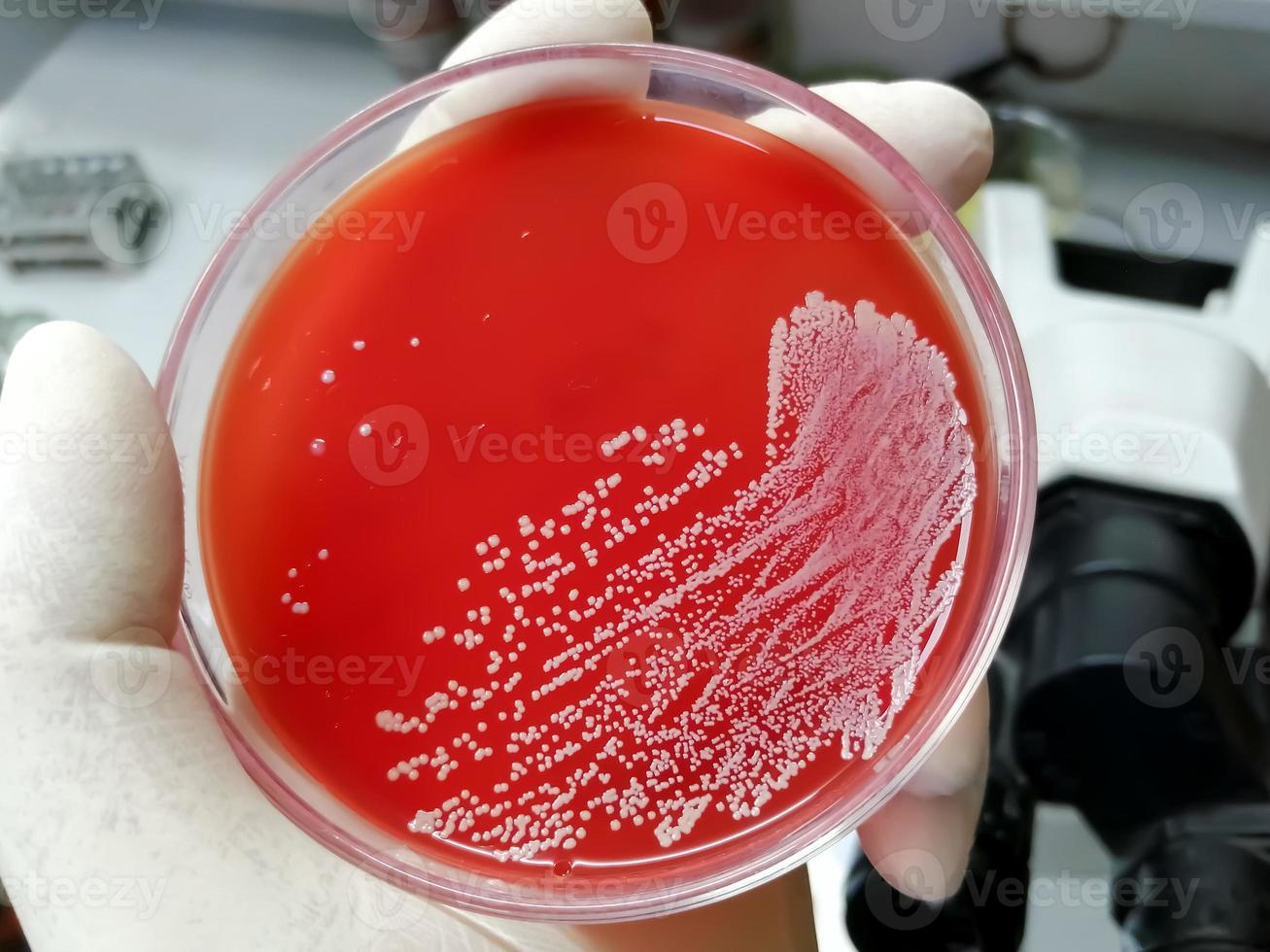 staphylococcus aureus, gram positivo, a gram variable, inmóvil, coco, beta hemólisis, bacteria saprotrófica que pertenece a la familia de los estafilococos crecimiento en agar sangre. foto