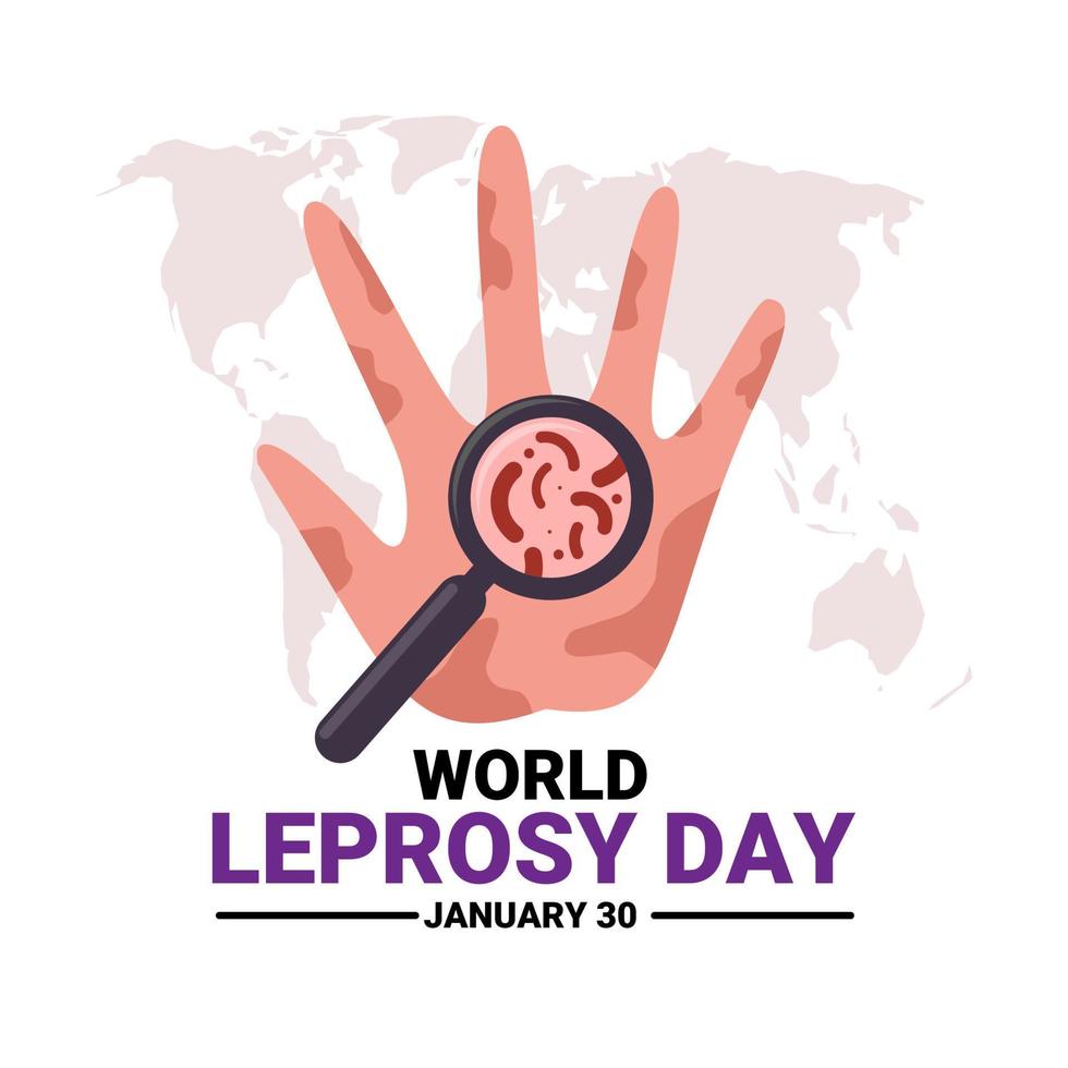Vector illustration, hand affected by leprosy, with a magnifying glass as a symbol of analysis, as a banner or poster, World Leprosy Day.