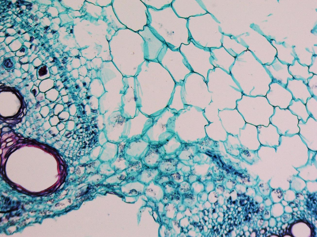 Cucurbita stem micrograph photo