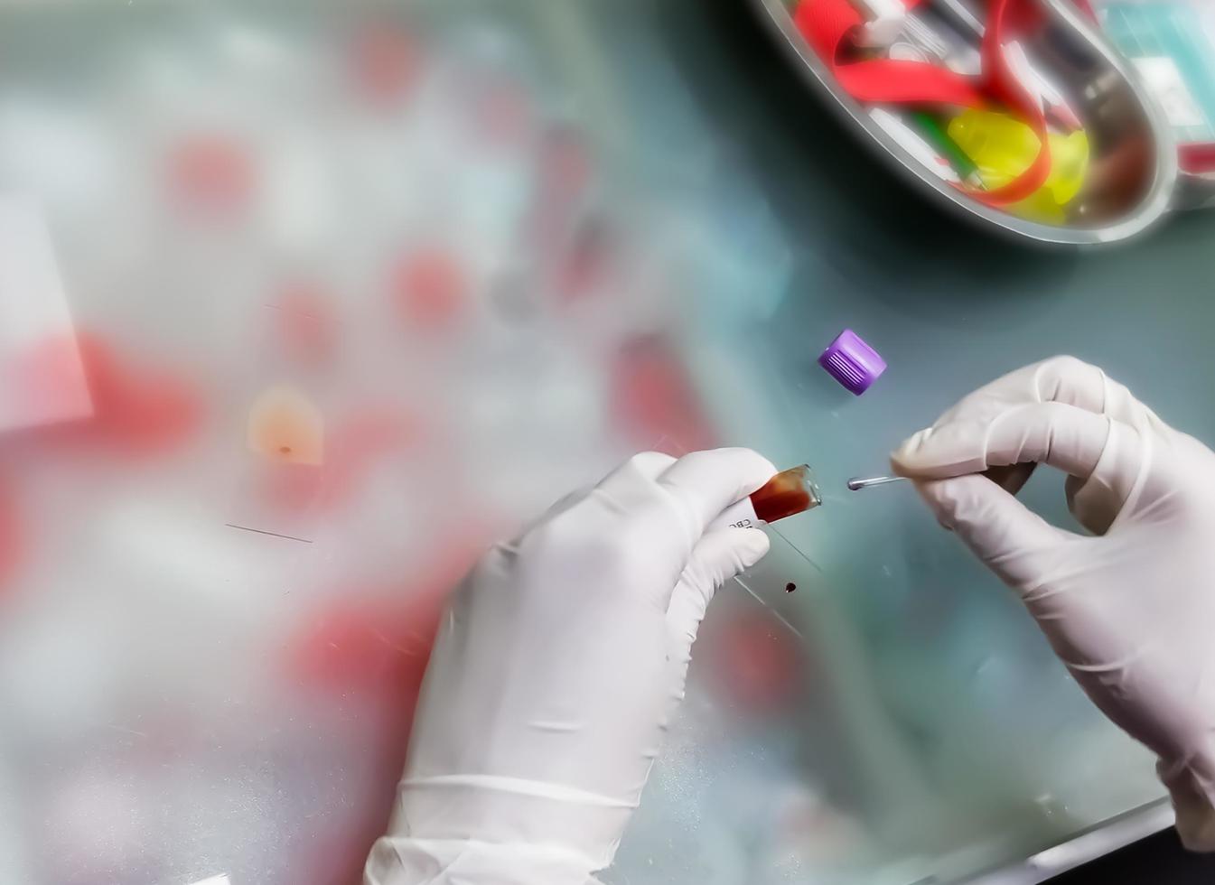 Laboratory technician or health worker preparing for a blood smear test or blood film. slide with a drop of blood photo