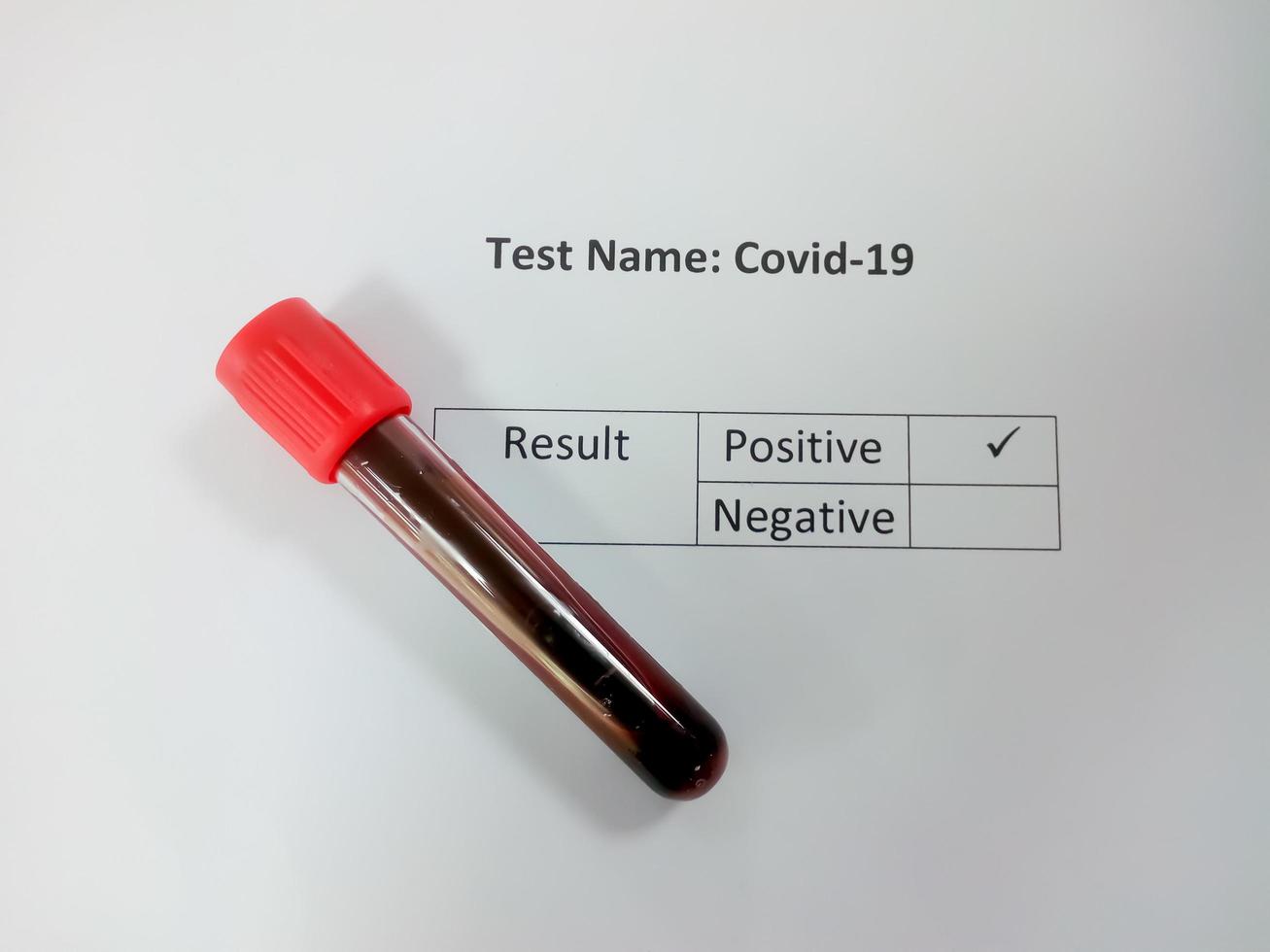 Covid-19 test in laboratory. Corona virus test. Positive result. Writing concept. Close up. medical article concept. photo