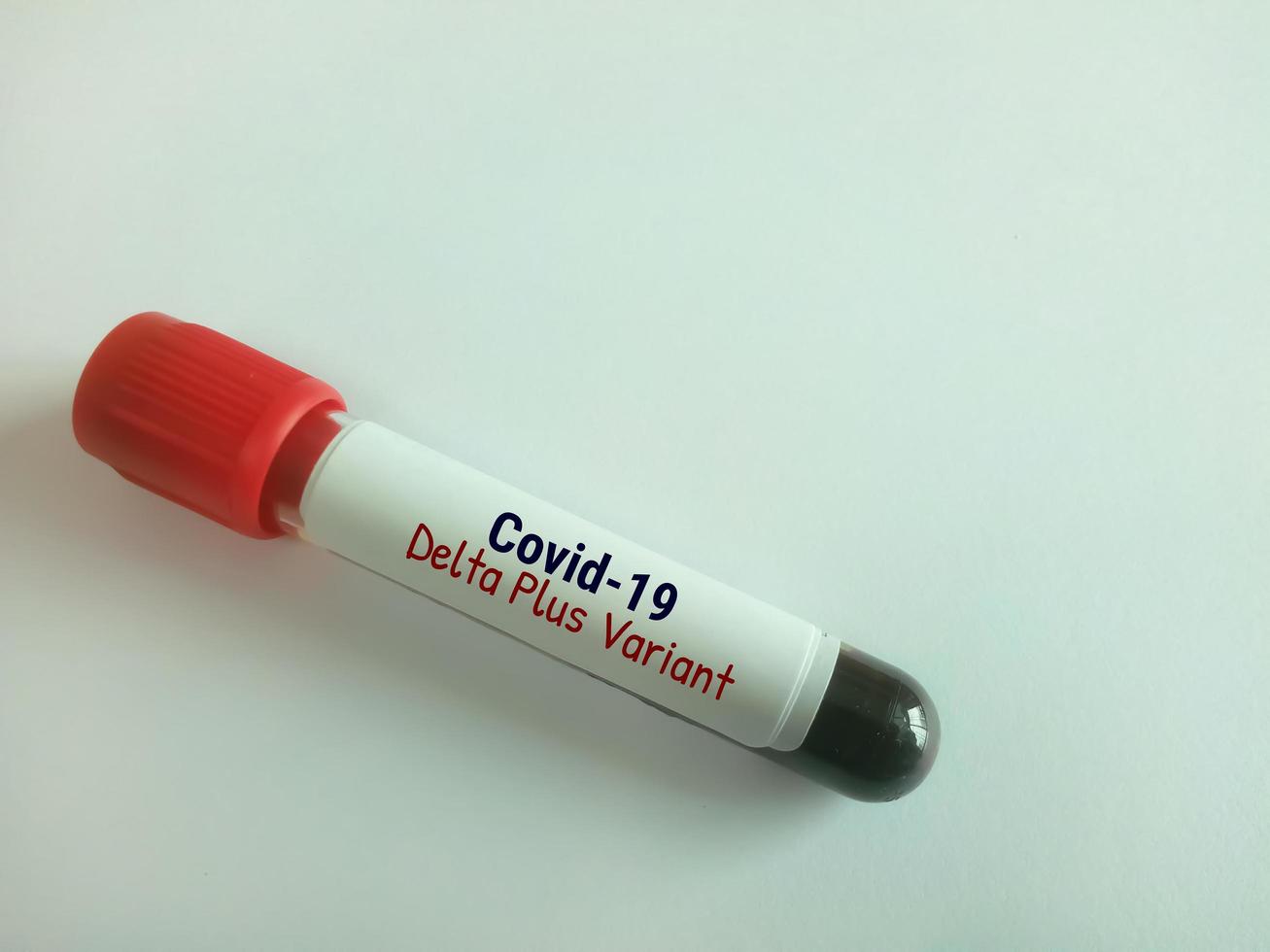 Scientist hold blood sample for Covid-19 Delta plus variant test photo