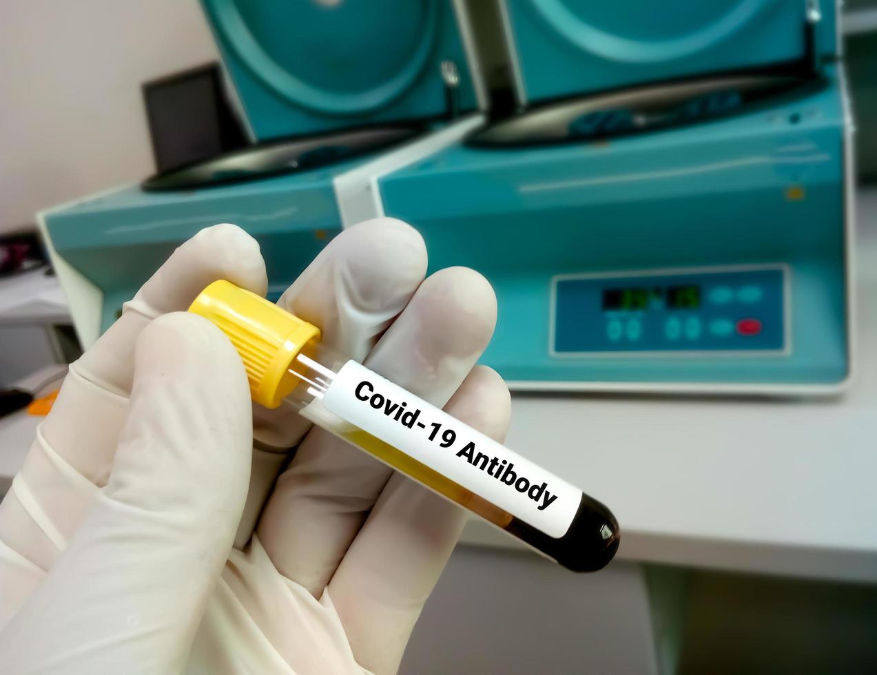 Antibody testing for coronavirus infection. Checking the population for immunity to covid 19. photo