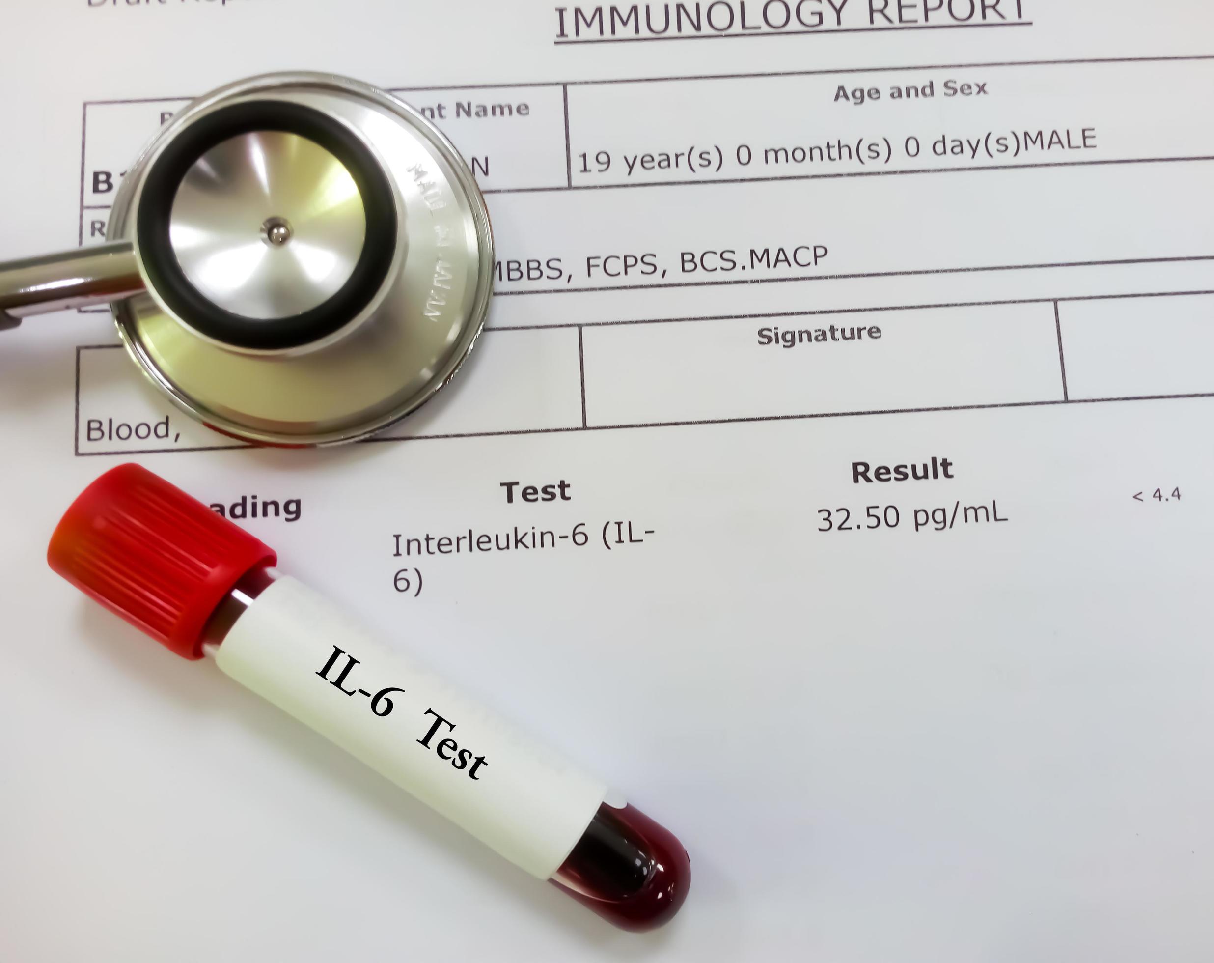 Blood sample tube isolated on abnormal high Interleukin-6 or ...