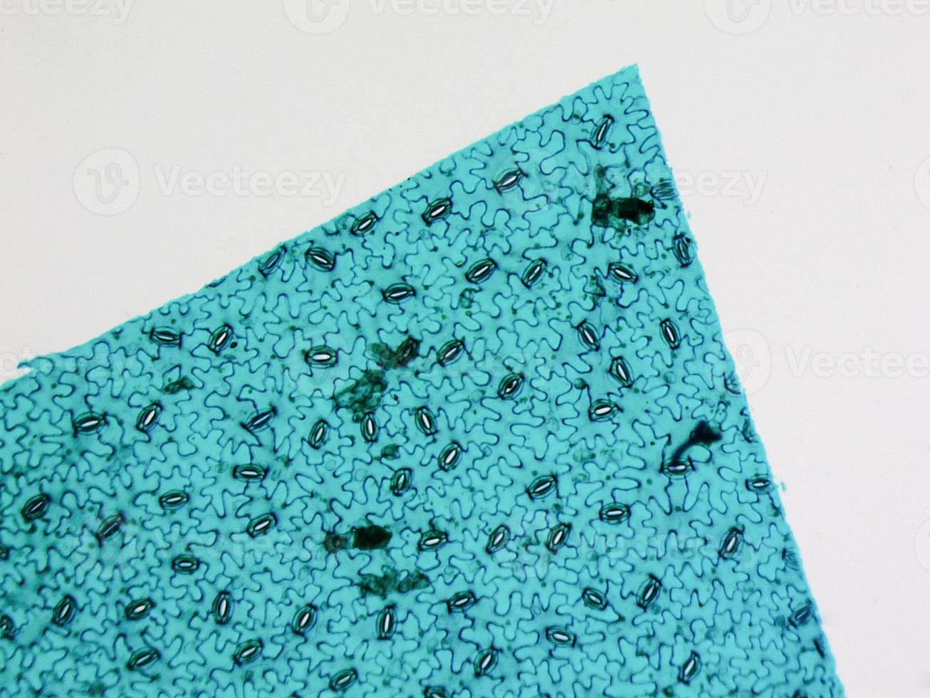 Stoma light micrograph photo