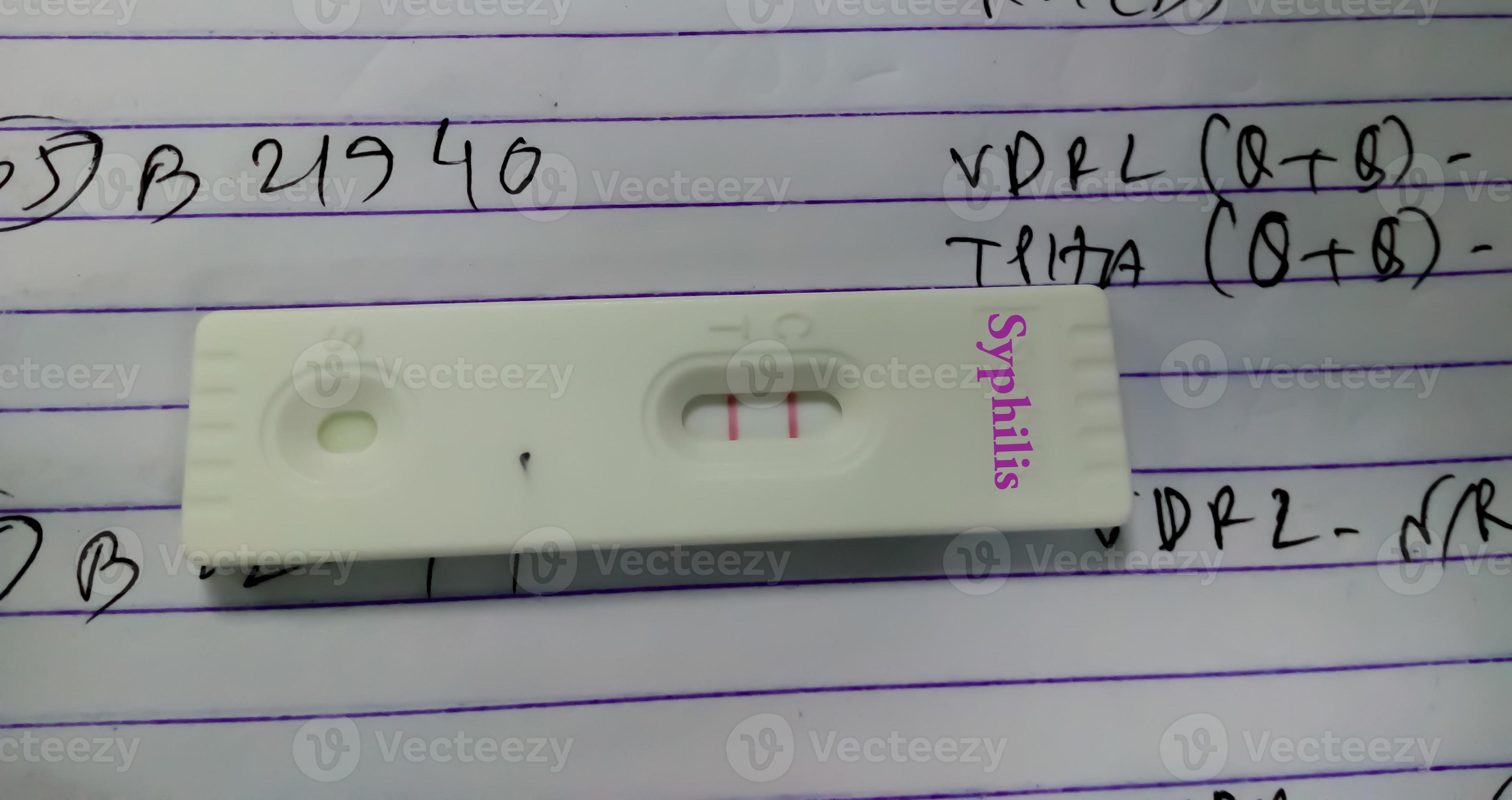 Close view of device of Syphilis, rapid screening test show positive