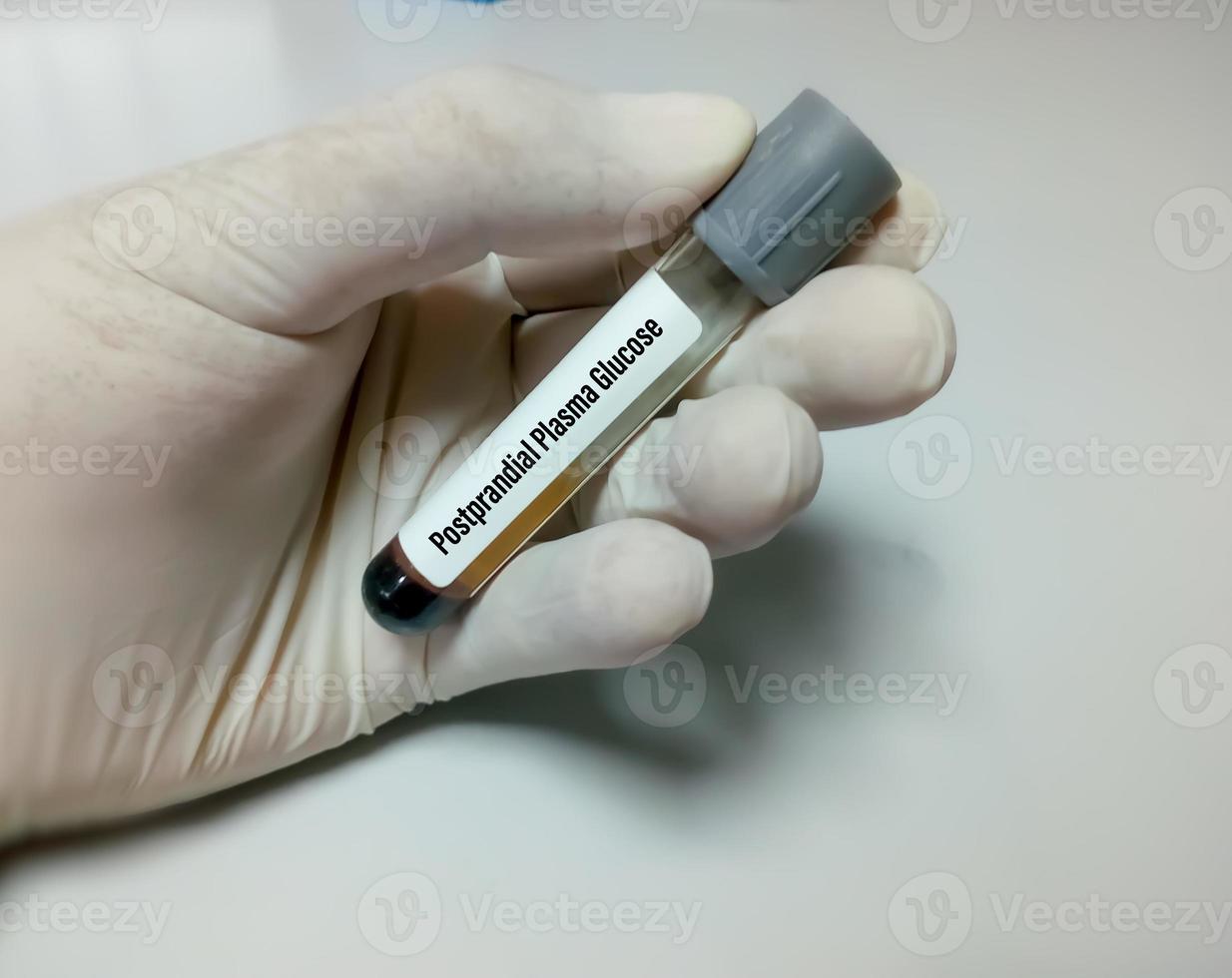 Technician or scientist hold Blood sample for Postprandial Plasma Glucose or PPPG photo