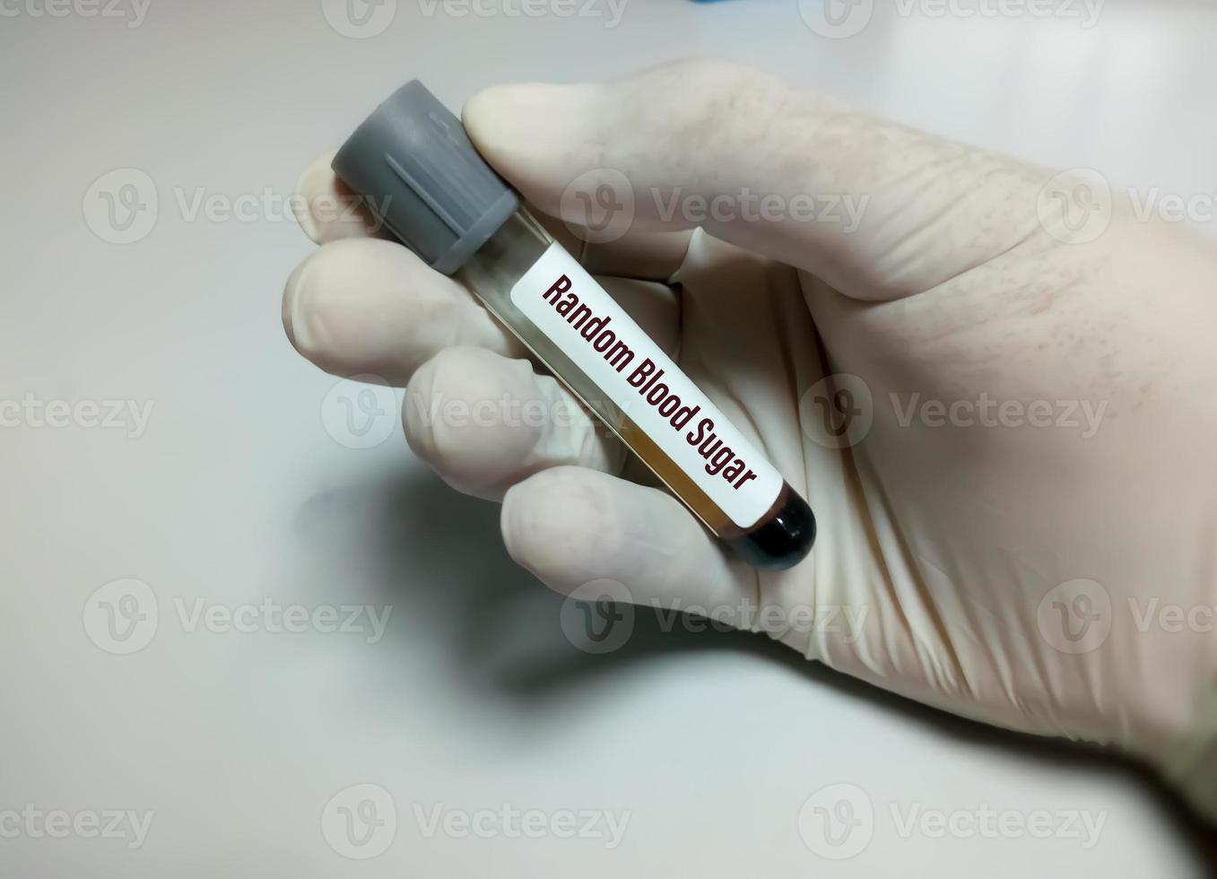 técnico o científico sostiene un tubo de muestra de azúcar en sangre al azar o prueba de rbs. concepto de prueba médica foto