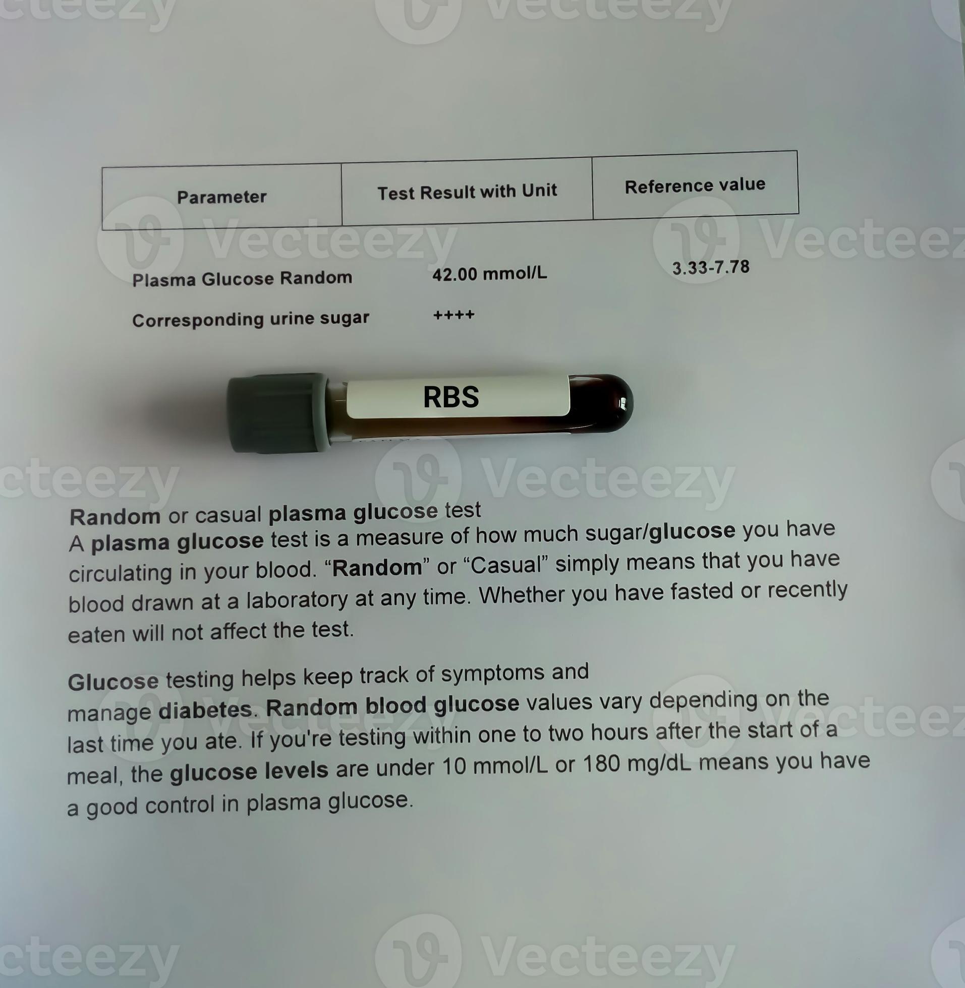 Technician or scientist hold Blood sample for Random Blood Sugar or RBS