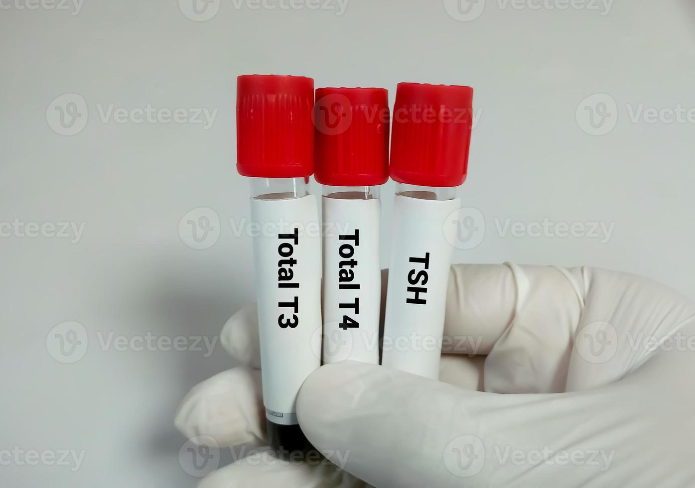 Blood sample in test tubes for hormonal examination of thyroid gland in laboratory. Total T3, Total T4, TSH. Diagnosis of hyperthyroidism or hypothyroidism of a patient photo