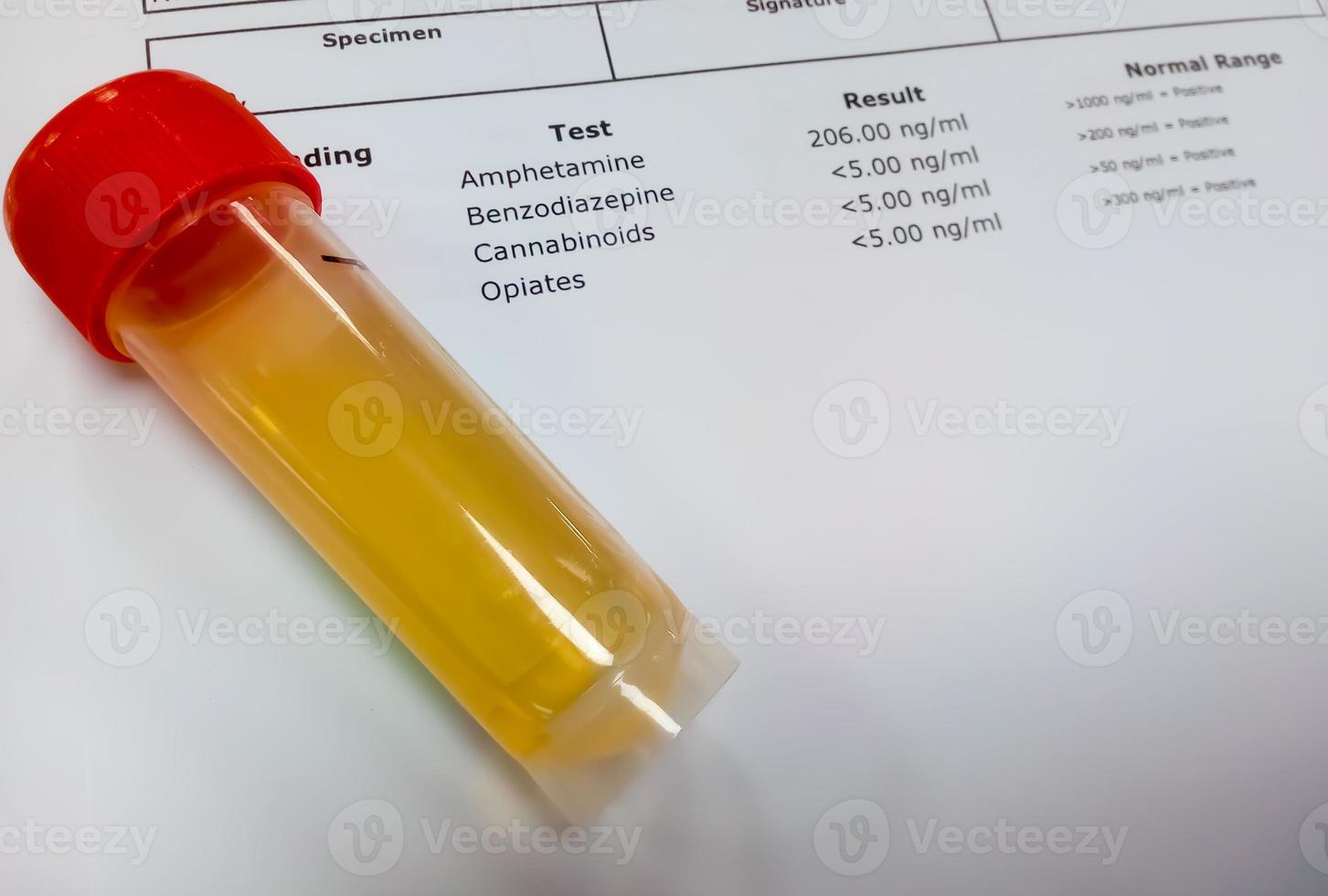 muestra de orina para prueba de drogas. La prueba de drogas es el análisis técnico de la muestra para determinar el abuso de drogas ilegales como benzodiacepinas, cannabis, anfetaminas, opiáceos. foto