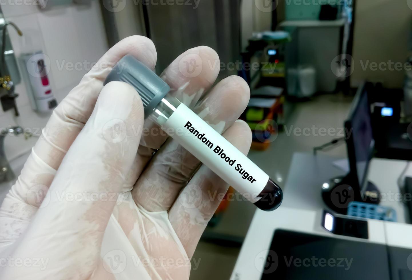 Technician or scientist hold a sample tube of Random Blood Sugar or RBS test. Medical testing concept photo