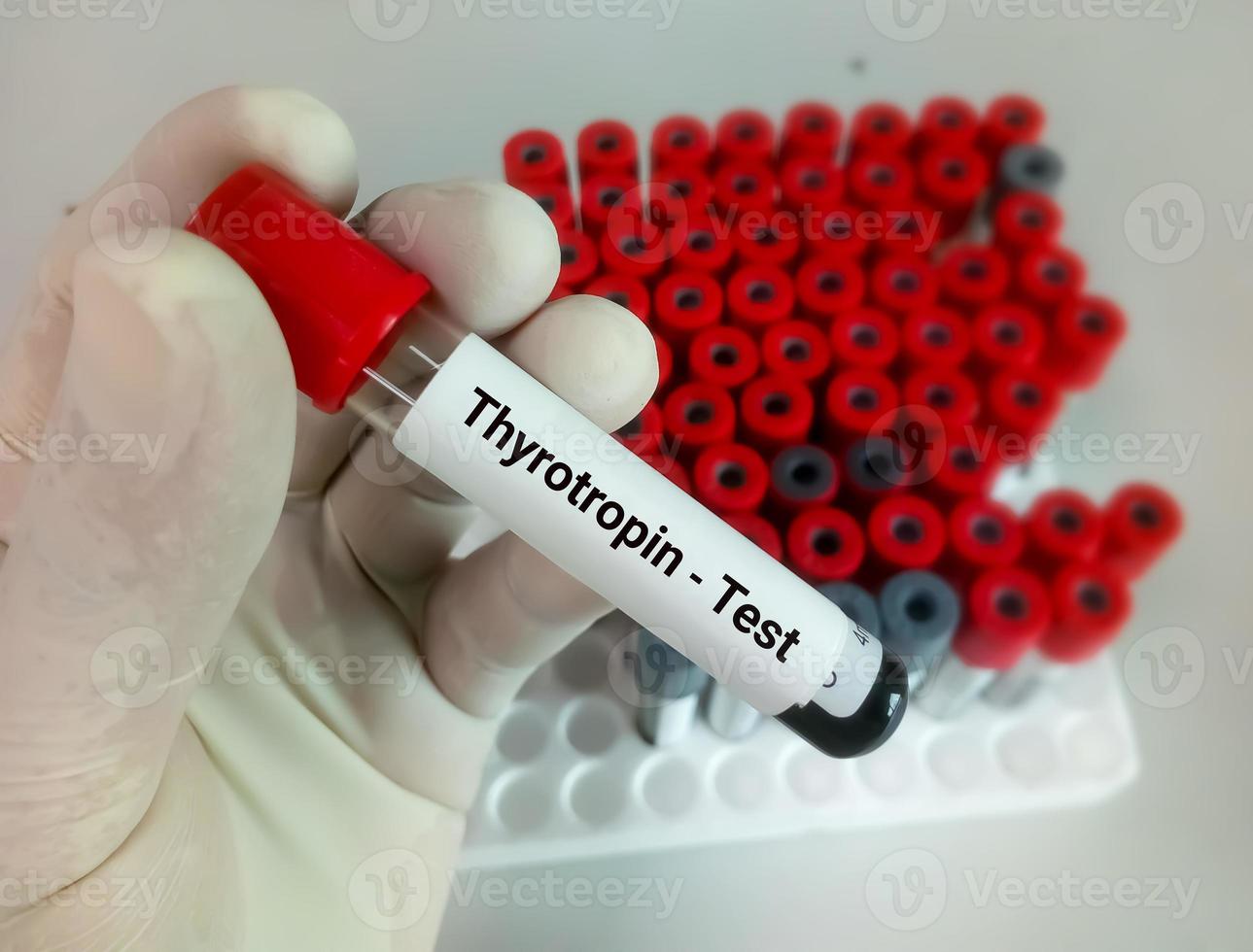 Blood sample in test tube for hormonal examination of thyroid gland in laboratory. Thyrotropin or TSH, diagnosis of hyperthyroidism or hypothyroidism of a patient photo