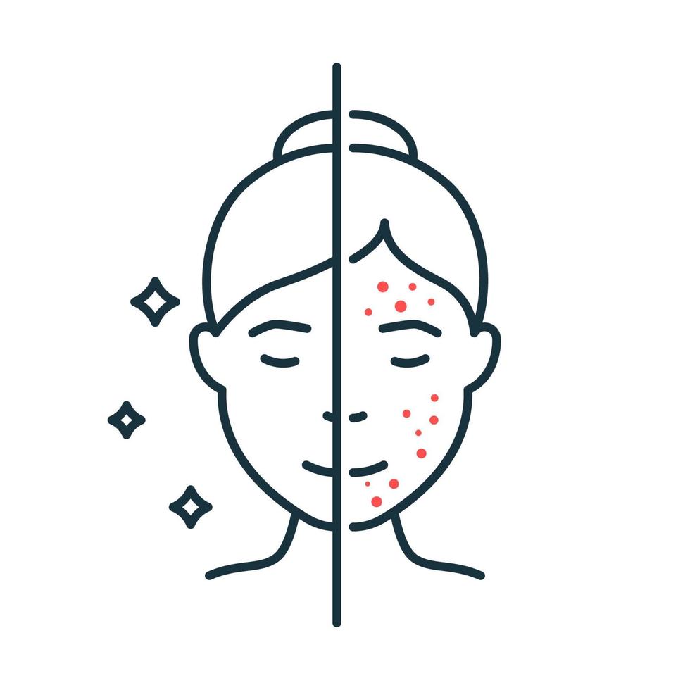 Woman with Acne and Clean Face Skin Line Icon. Female Skincare for Cleansing Face and Problem Skin Outline Icon. Girl Before and After Skin Treatment Linear Pictogram. Isolated Vector Illustration. 5482662 Vector